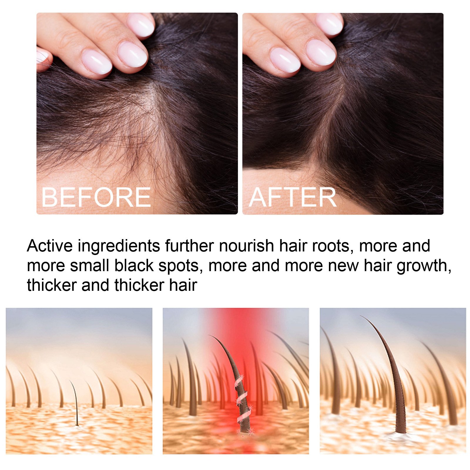 EELHOE Natural Ginger Products Fast Hair Growth Serum Oil Anti Loss Serum Oil Hair Regrowth Conditioners