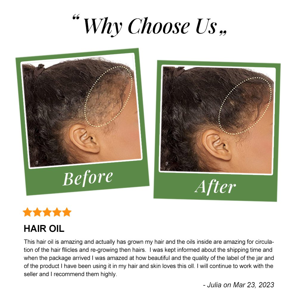 Private Label OEM/ODM 100% Natural Organic Peppermint & Rose Coffee Men And Women Hair Treatment Growth Oil