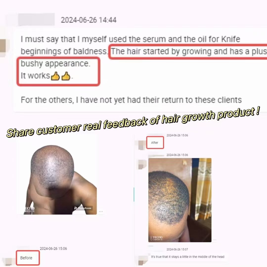 Private Label Strong Shampoo with Rosemary and Mint Oil, Helps Promote Hair Growth and Reduce Hair Loss, for Dry Damaged Hair