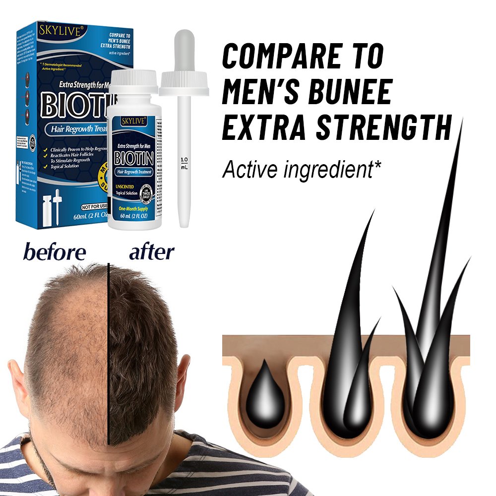 OEM 60ml Fast Hair Regrowth Serum Hair Growth Tonic Treatment For Men And Women