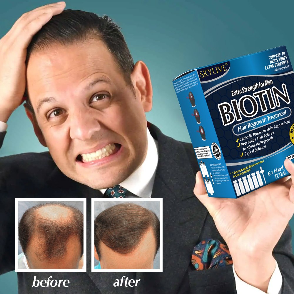 OEM 60ml Fast Hair Regrowth Serum Hair Growth Tonic Treatment For Men And Women