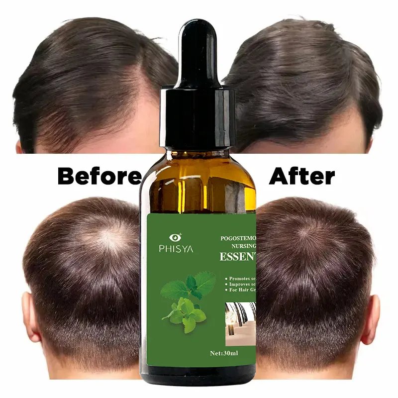 Hair Care Set Anti-Loss Hair Growth Vitamin E Plant Extract Hair Oil Treatment Care Anti-Dandruff Shampoo & Conditioner