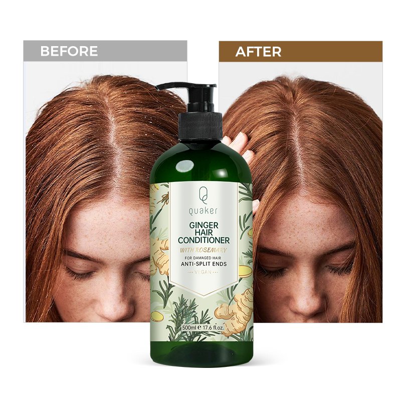 Qquaker Manufacturer Hair Loss Prevention Custom Logo Private Label Hair Care Set Shampoo And Conditioner With Ginger