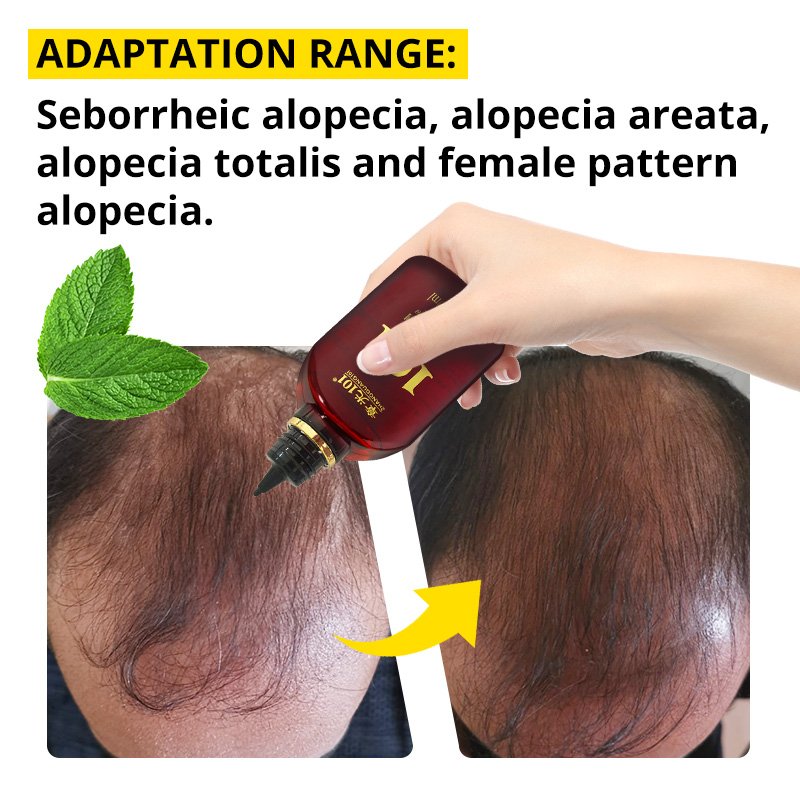 High Quality Chinese Herbal Extracts Rapid Hair Growth Serum 120ml Nourishing Daily Use for Adults