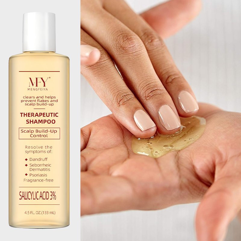 3% salicylic acid anti-dandruff and anti-itch treatment shampoo for seborrheic dermatitis and psoriasis treatment shampoo