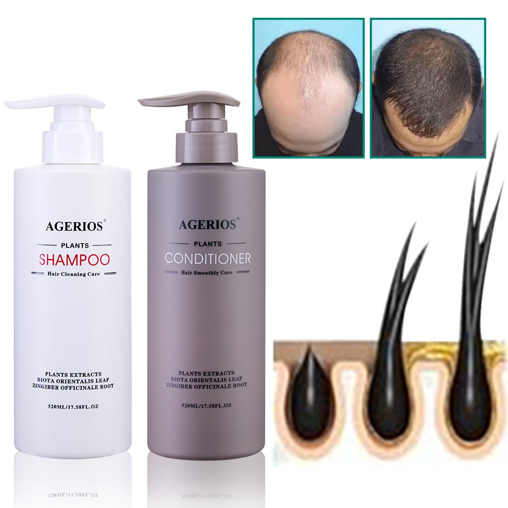 Paraben Free Sulfate Free Hair Loss Shampoo And Conditioner Wholesale Peppermint Natural Hair Growth Shampoo