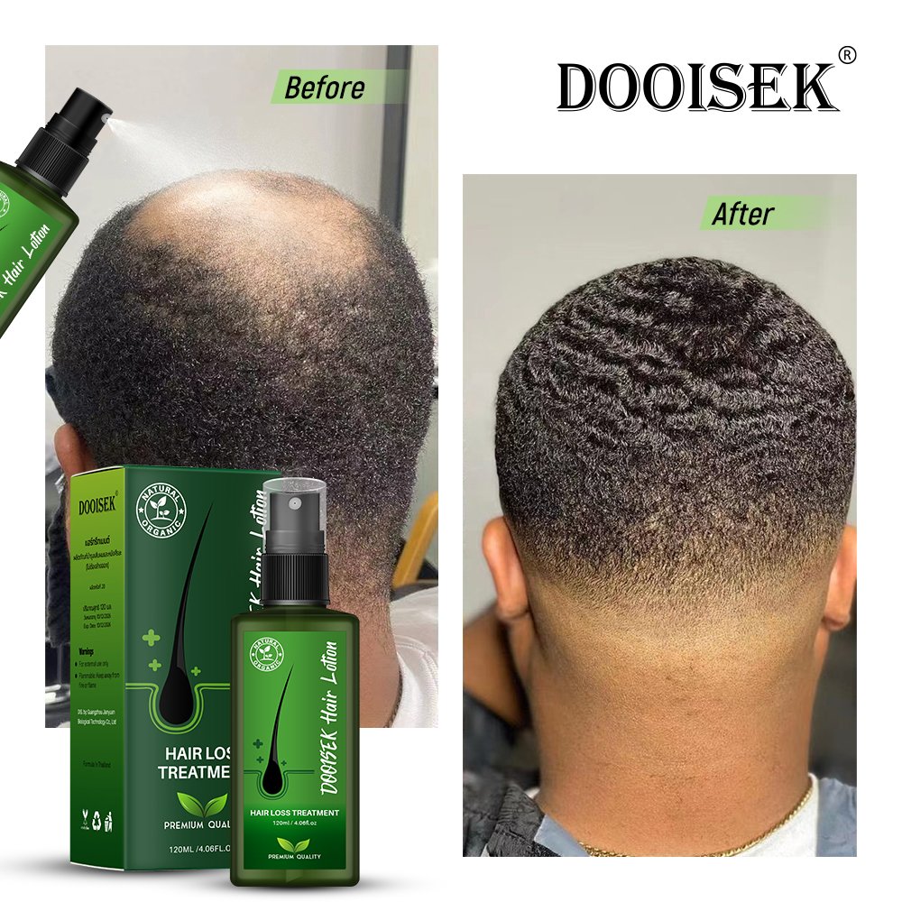 DOOISEK hot selling 2023 OEM 120ml Thailand Promote hair regrowth serum anti loss herbal biotin hair growth oil tonic spray