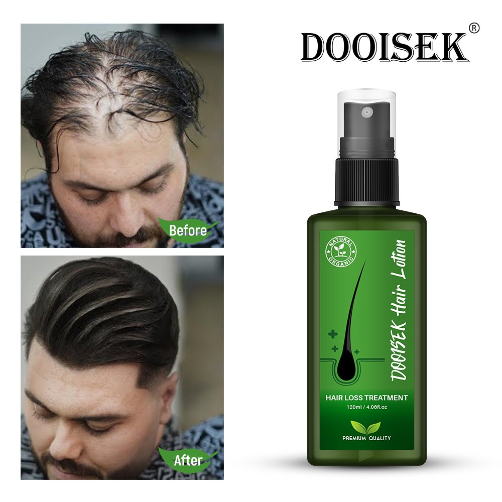 DOOISEK hot selling 2023 OEM 120ml Thailand Promote hair regrowth serum anti loss herbal biotin hair growth oil tonic spray