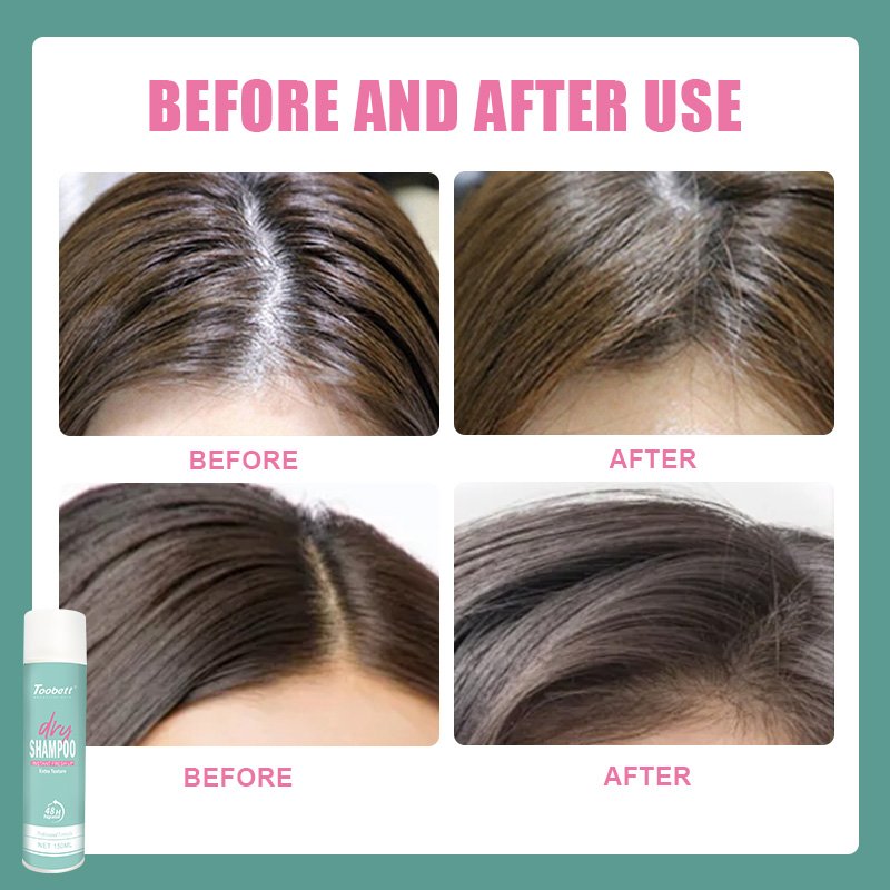 Dry Shampoo Spray Instant Clean and Volume Boost 150ml