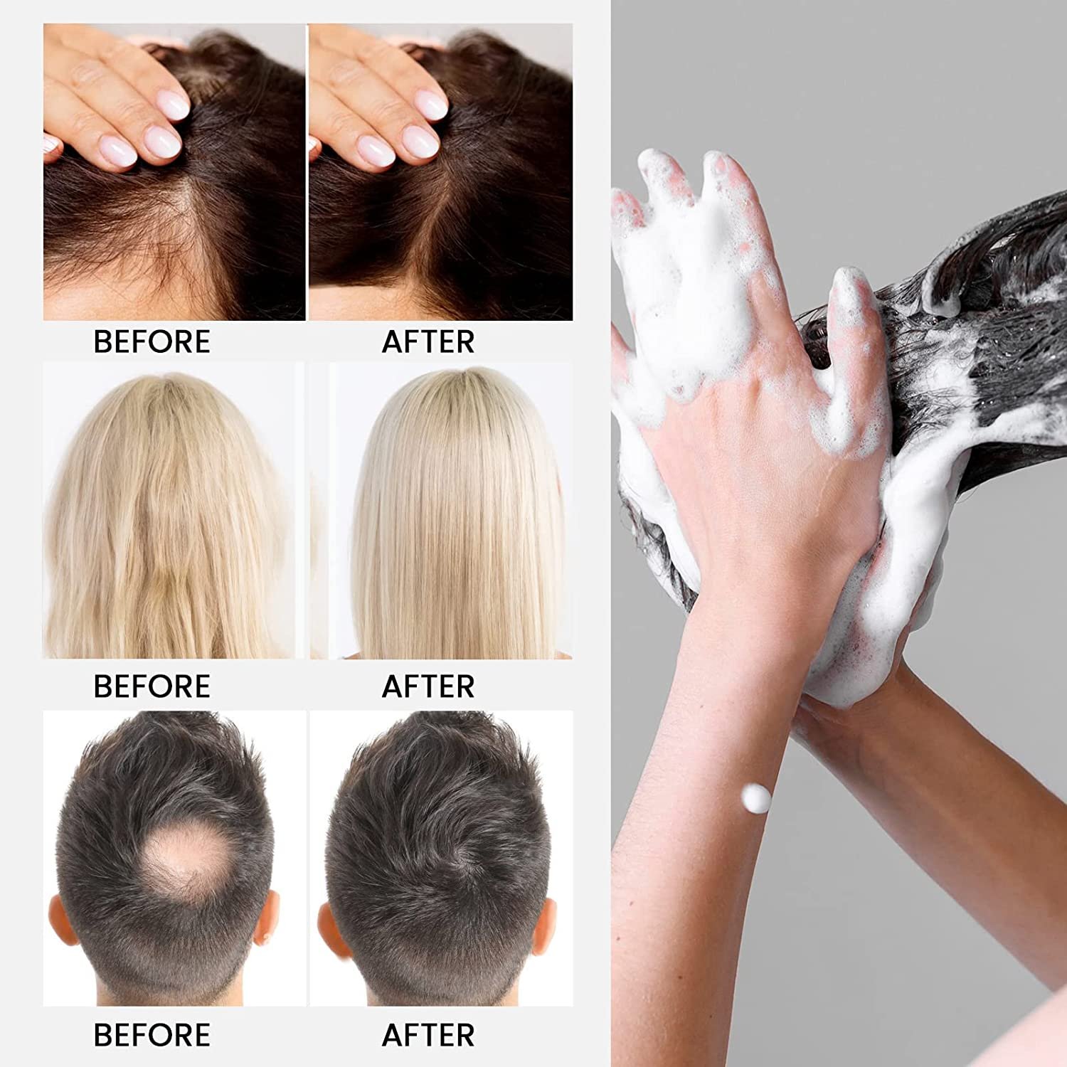 New hot selling hair shampoo and conditioner black hair regrowth loss shampoo anti-hair loss rice water shampoo