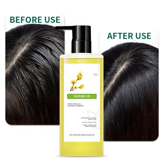 100% Natural Refreshing Oil Control Shampoo Guangzhou Manufacturer Wholesale Private Label Shampoo Witch Hazel Shampoo For Hair