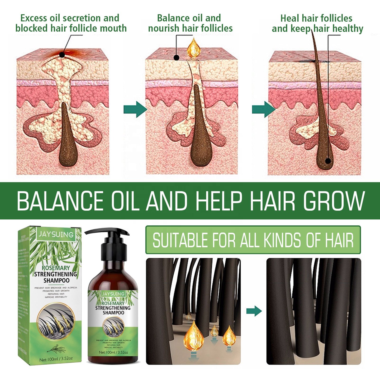 Jaysuing 100% Natural Strengthening Refreshing Fluffy Smooth Oil Control Best Anti Hair Loss Hair Growth Rosemary Shampoo