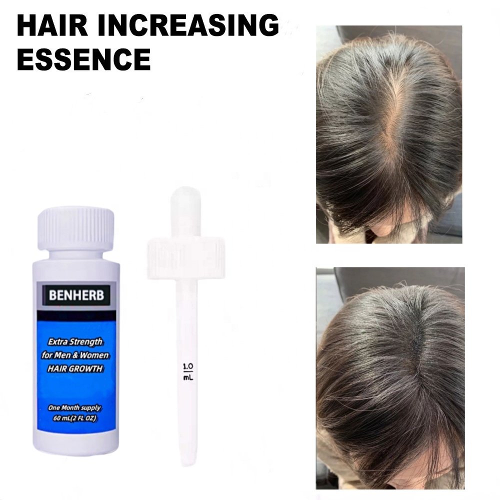 5% Kirkland Hair Growth Oil 60 ml Liquid Tonic Serum Super Fast Hair Growth Product Organic Coconut oil Main Ingredient