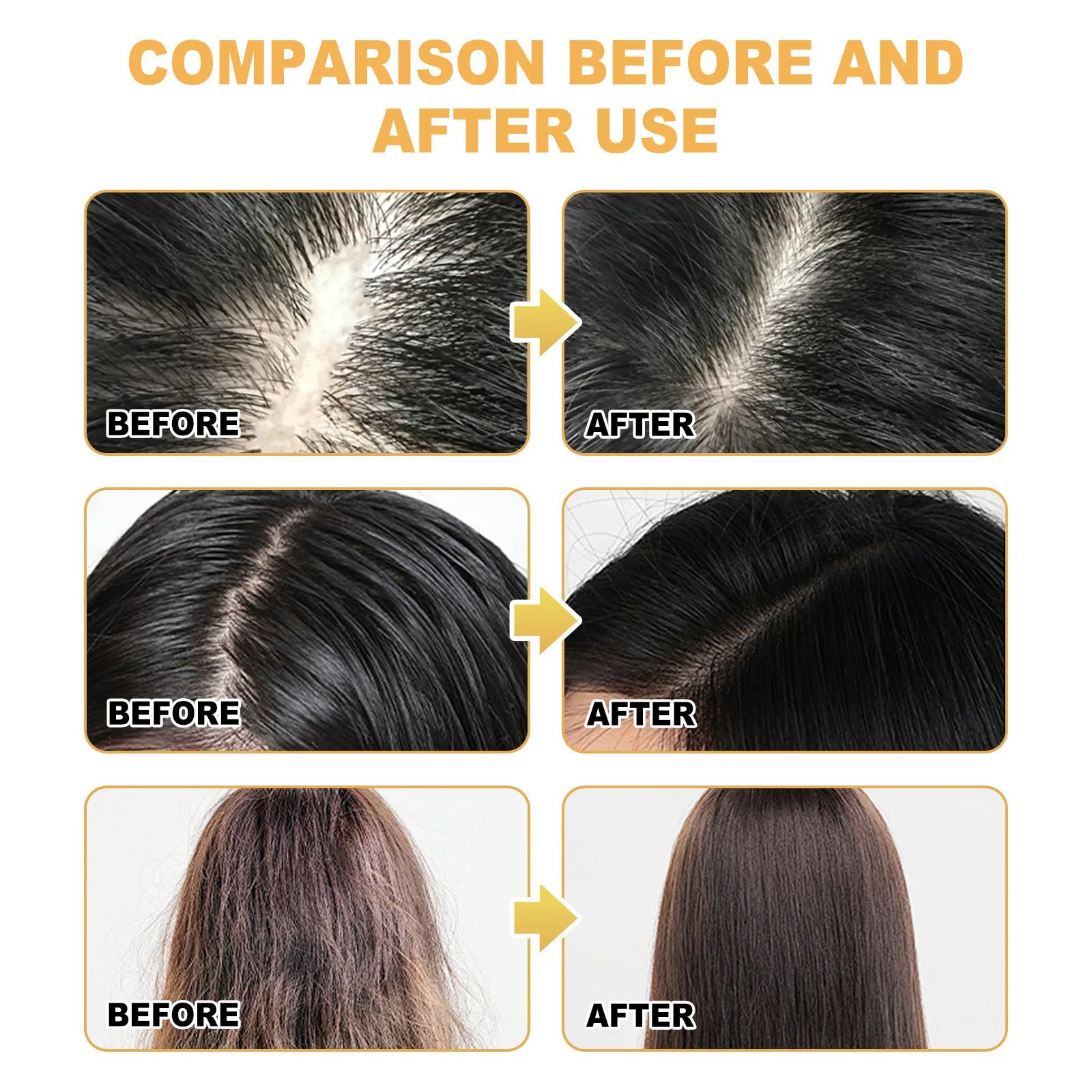OEM Private Label Rice essence Shampoo For Molsturizes hair Protect hair health Hair Growth Rice shampoo