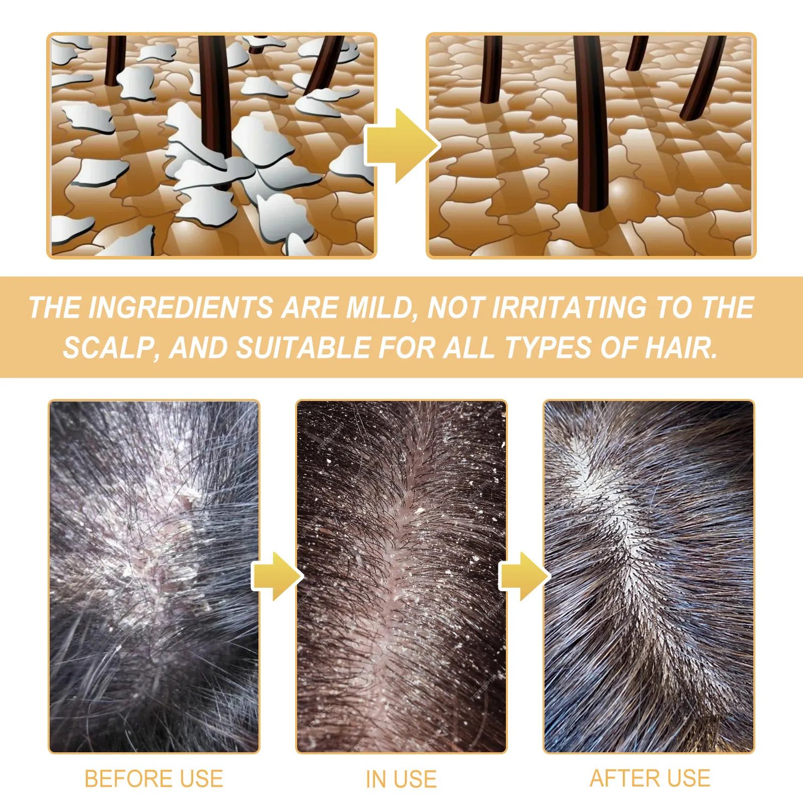 OEM Private Label Rice essence Shampoo For Molsturizes hair Protect hair health Hair Growth Rice shampoo