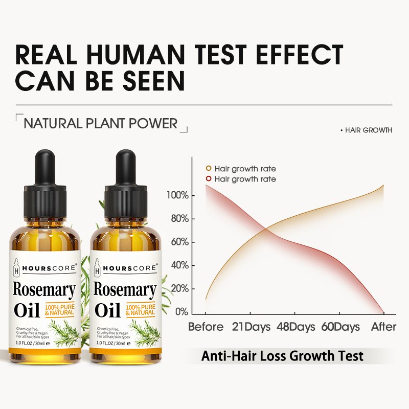 OCCA 100% Natural Custom Veganic Organic Private Label Ginger Essential Fast Hair Wild Growth Serum Oil For Black Women Men Kids