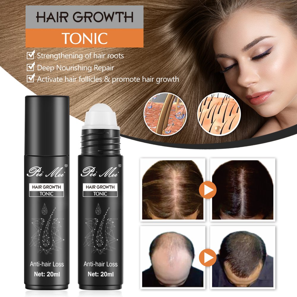 Peimei 100% Organic Ginger Plant Extract Anti-Hair Loss Hair Growth Tonic Oil Activate Follicles Promote Hair Growth Serum