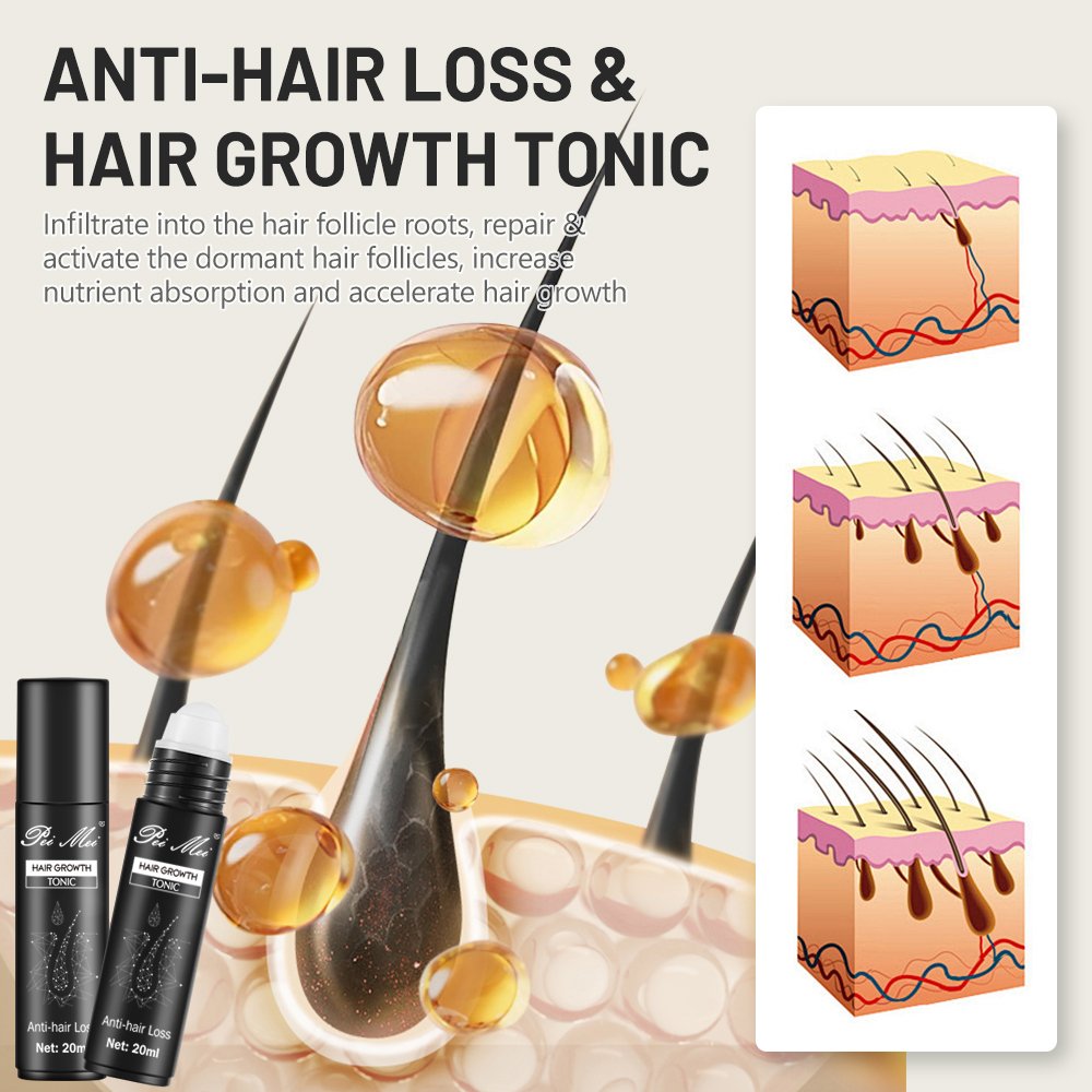 Peimei 100% Organic Ginger Plant Extract Anti-Hair Loss Hair Growth Tonic Oil Activate Follicles Promote Hair Growth Serum