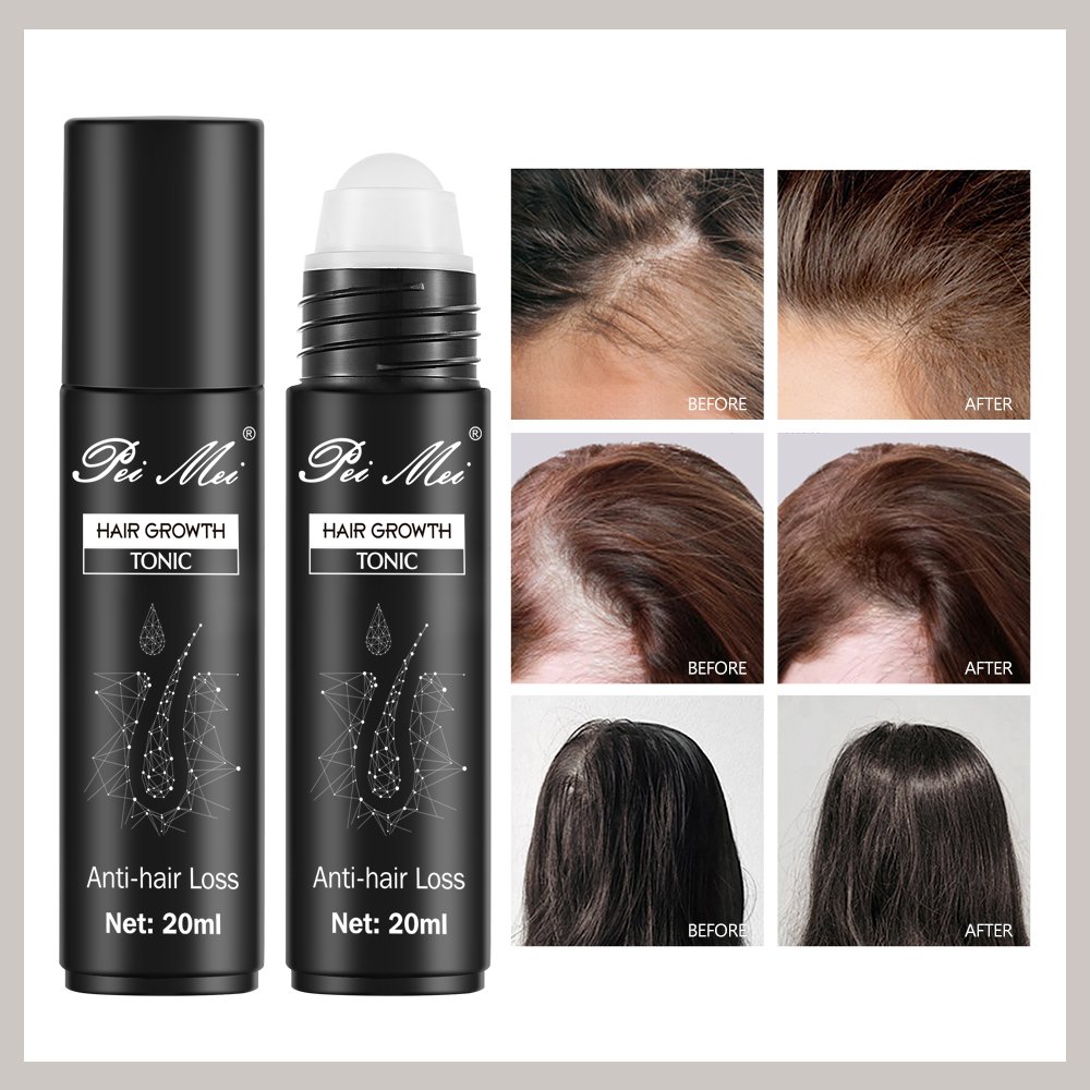 Peimei 100% Organic Ginger Plant Extract Anti-Hair Loss Hair Growth Tonic Oil Activate Follicles Promote Hair Growth Serum