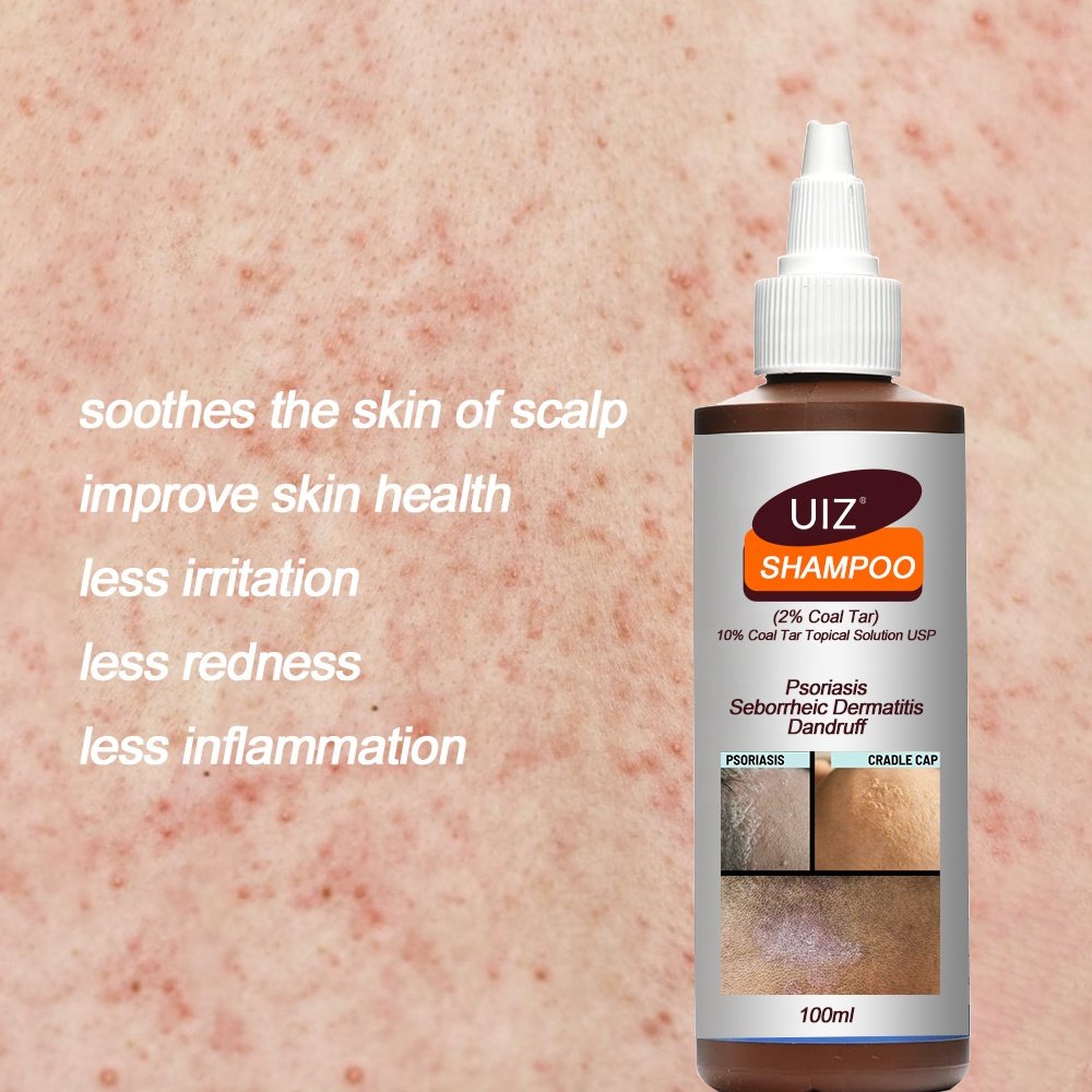 Psoriasis Shampoo Anti Itching Scalp Care Seborrheic Cream Repair Treatment Dandruff Hair Shampoo