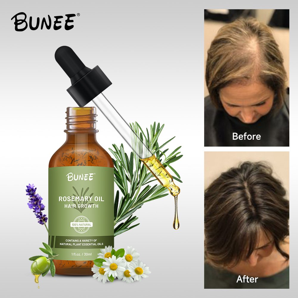 60ml OEM Organic formula leave in premium Quality Booster hair follicle rosemary oil hair growth toinc oil