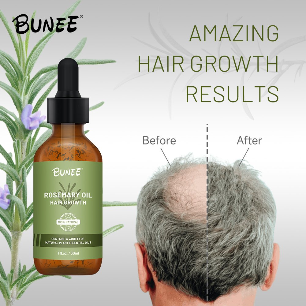 60ml OEM Organic formula leave in premium Quality Booster hair follicle rosemary oil hair growth toinc oil