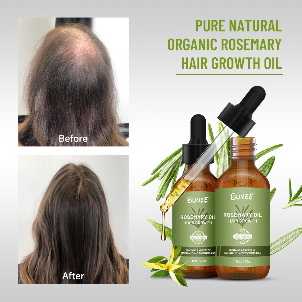 60ml OEM Organic formula leave in premium Quality Booster hair follicle rosemary oil hair growth toinc oil