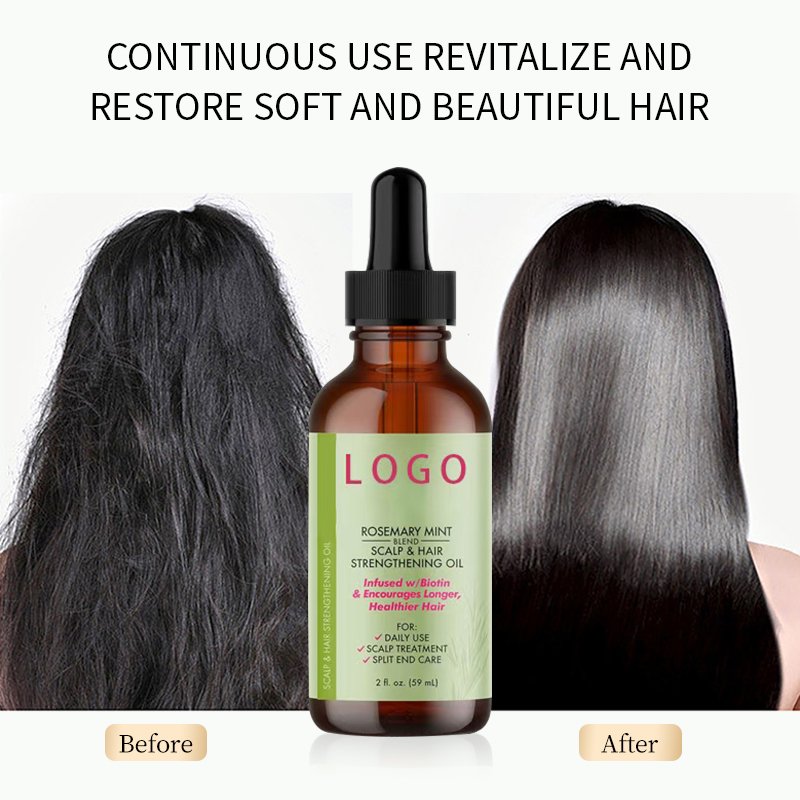 OEM Organic Rosemary Mint Scalp Conditioner Essential Oil For Hair Growth Nourishes Hair Encourages Growth Oil
