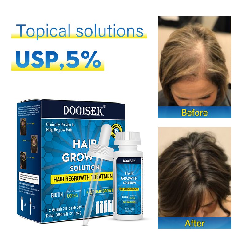 New Factory hair regrowth serum biotin hair growth serum natural hair care product With best quality