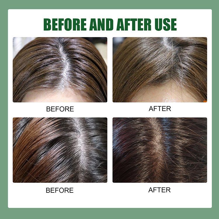 Private Label Hair Care Anti-Dandruff Deep Cleansing Massage Scrub Shampoo Exfoliating Hair Scrub For Oily Hair