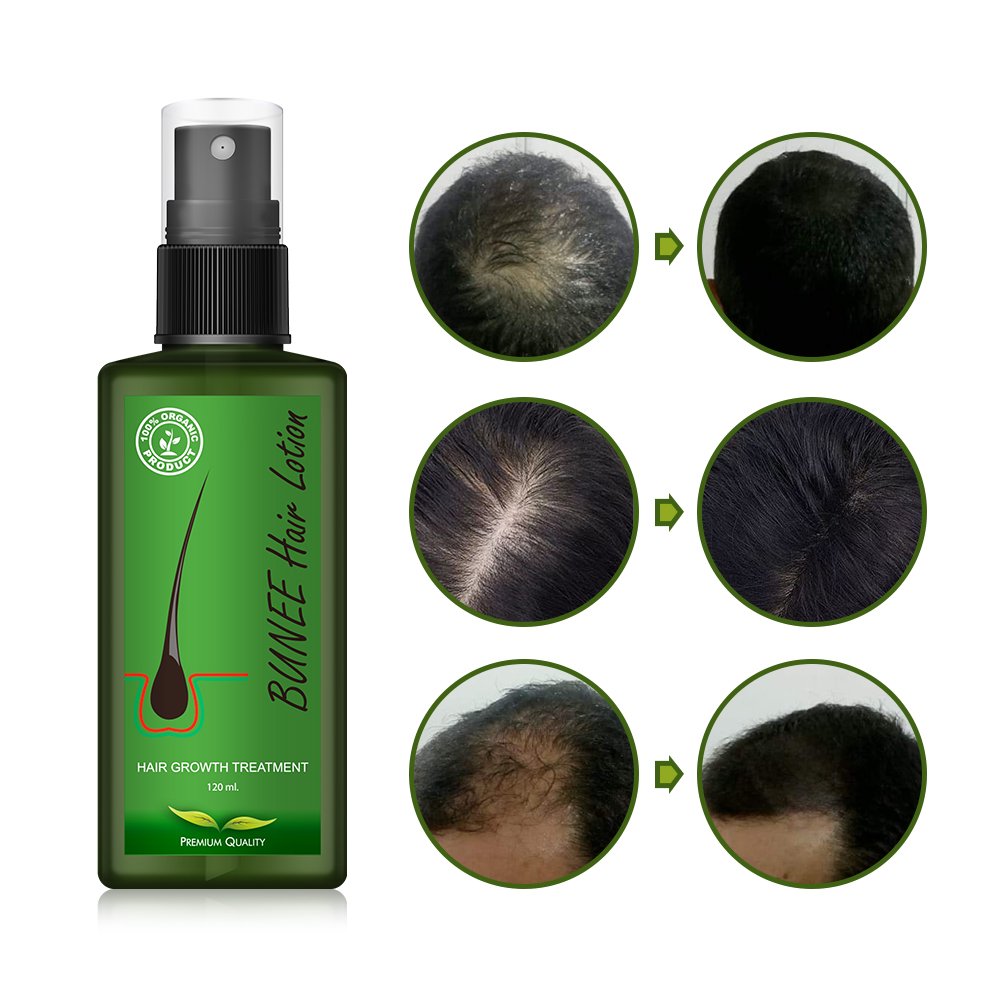 Thailand New Green Bottle Good Effective Fast Result BIOTIN Collagen Fast Hair Growth Serum
