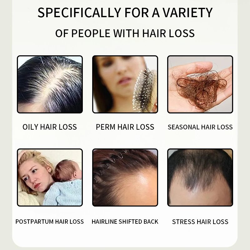 Extreme Fast Day and Night Custom Hair Repair Regrowth Rreatment Hair Growth Serum For Nourishing Scalp