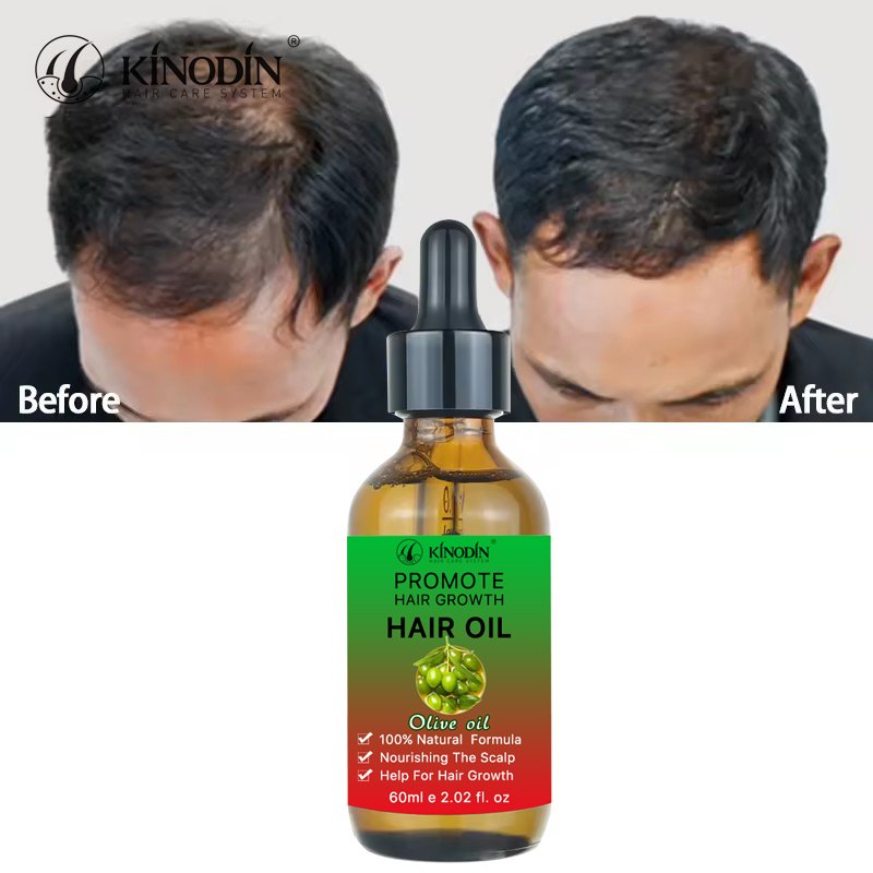 Best Selling Vegan 100% hair growth OLIVE Oil Keeps Hydrated hair spray Repair Damaged Deeply Nourishes Scalp Hair shampoo