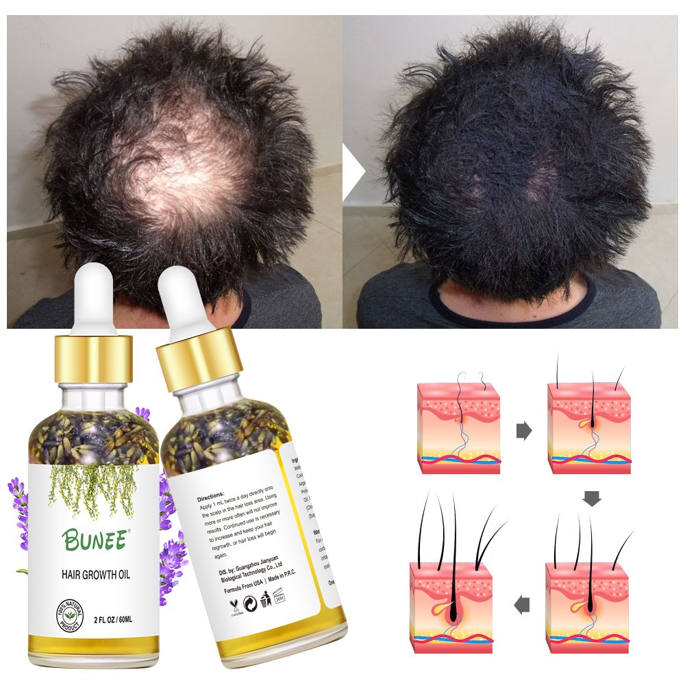 7days Fast effective Serum Factory Sell Fast Growth Wealth Hair Growth Lotion Hair Growth Scalp Serum