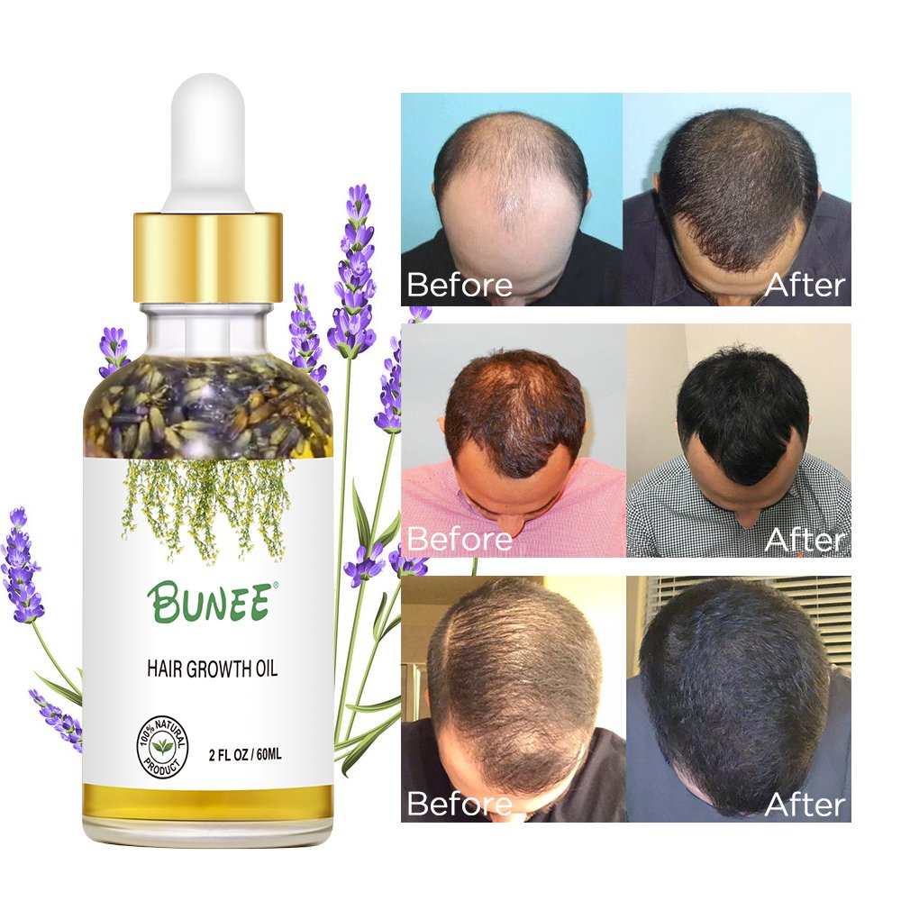 7days Fast effective Serum Factory Sell Fast Growth Wealth Hair Growth Lotion Hair Growth Scalp Serum