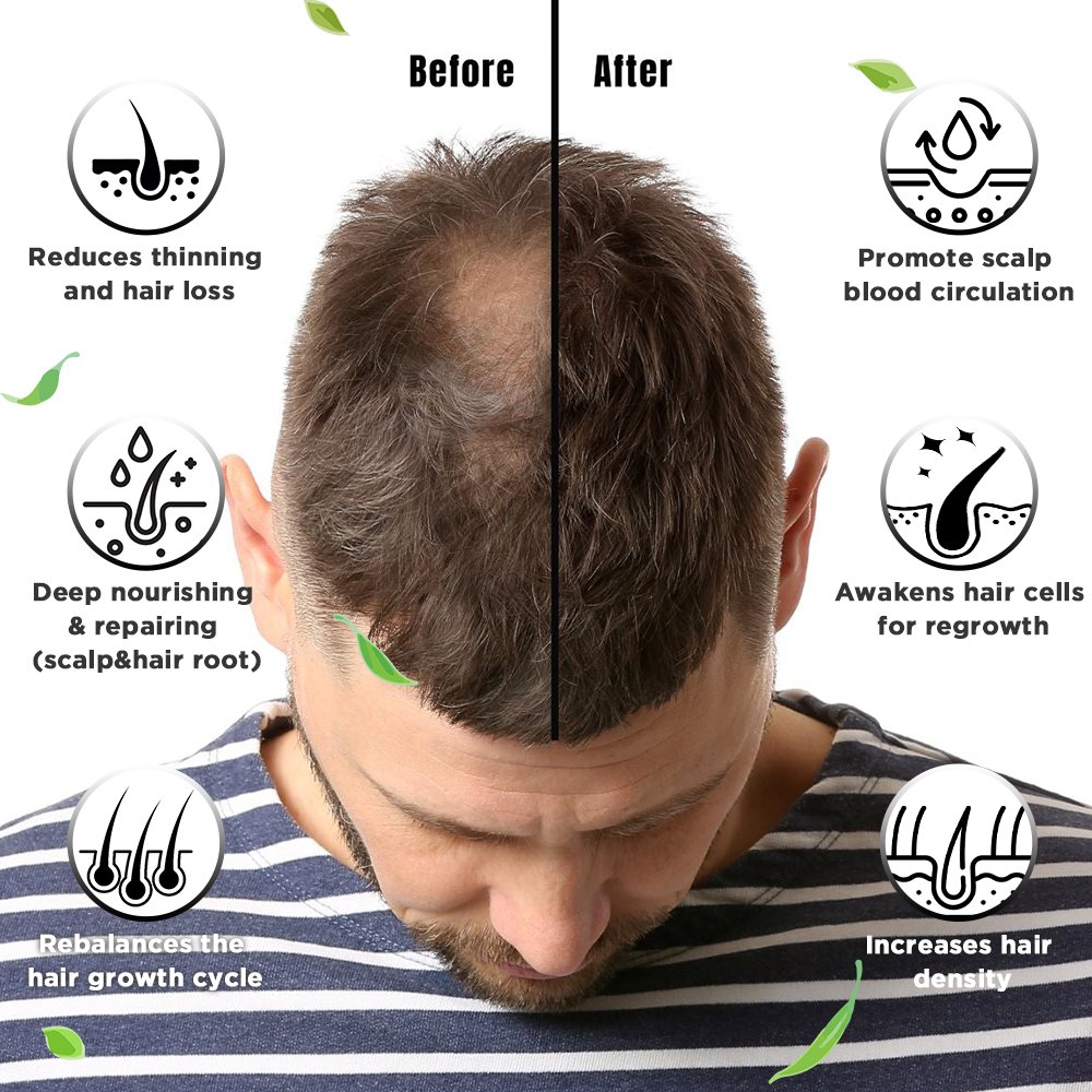 7days Fast effective Serum Factory Sell Fast Growth Wealth Hair Growth Lotion Hair Growth Scalp Serum