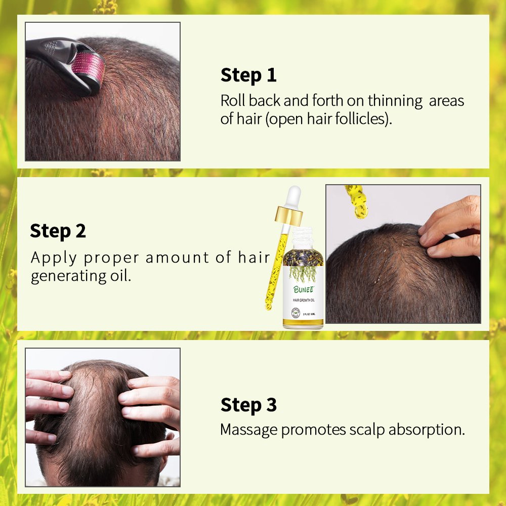 7days Fast effective Serum Factory Sell Fast Growth Wealth Hair Growth Lotion Hair Growth Scalp Serum