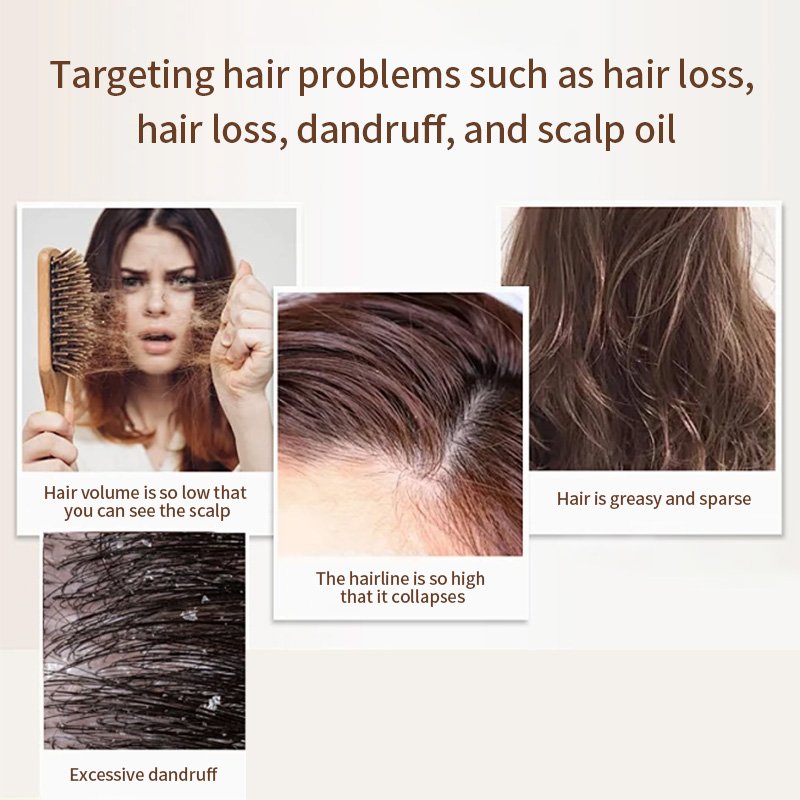 Anti Hair-Thinning deep moisturizing biotin shampoo custom natural hair growth shampoo and conditioner private label