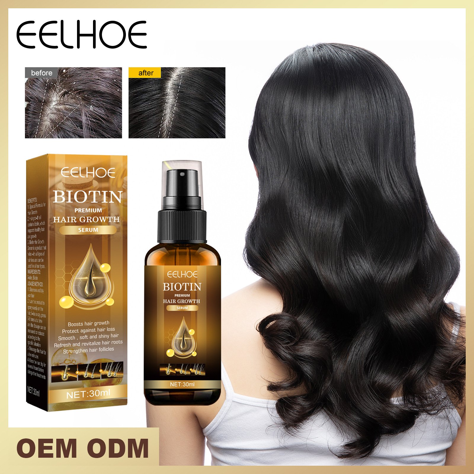 EELHOE Anti Hair Loss Treatment Serum Ginger Oil Serum Hair Regrowth Care Biotin Hair Growth Serum Oil For Men And Women