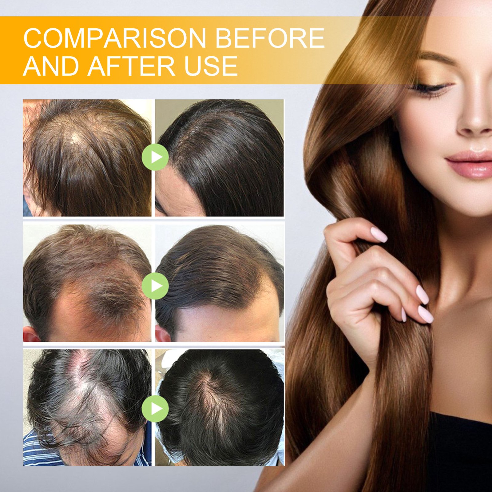 EELHOE Anti Hair Loss Treatment Serum Ginger Oil Serum Hair Regrowth Care Biotin Hair Growth Serum Oil For Men And Women
