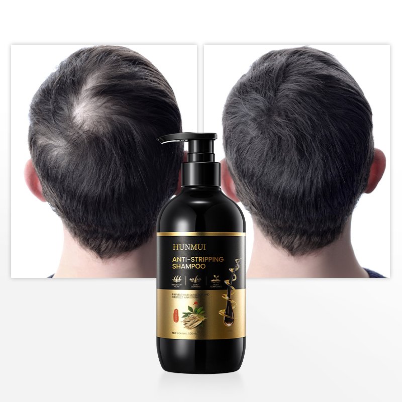 Fluffy Repairing Moisturizing Nourishing Anti Dandruff Repair Hair ginger shampoo