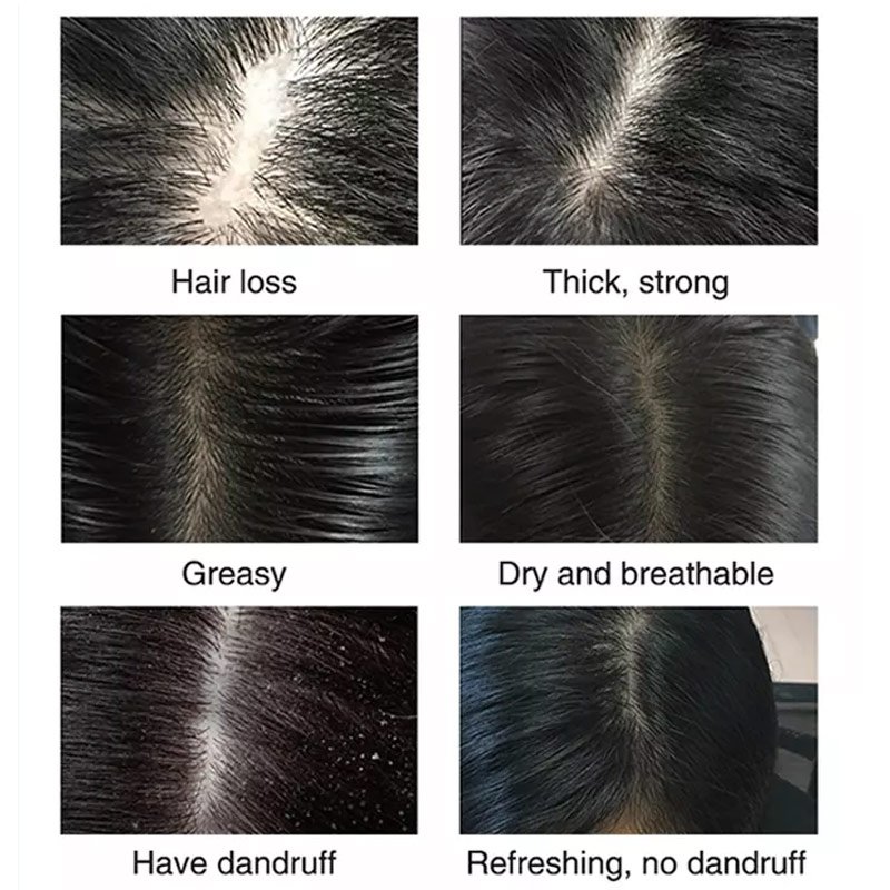 Biotin ginger smoothing hairburst hair loss products black hair shampoo