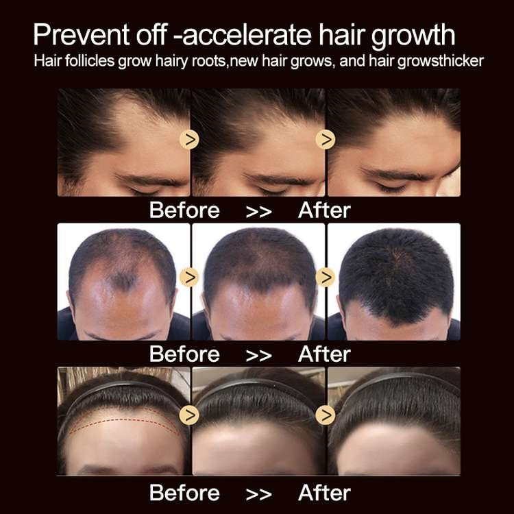 Private Label Hair Growth Ginseng Shampoo And Conditioner Regrowth Shampoos For Hair Loss