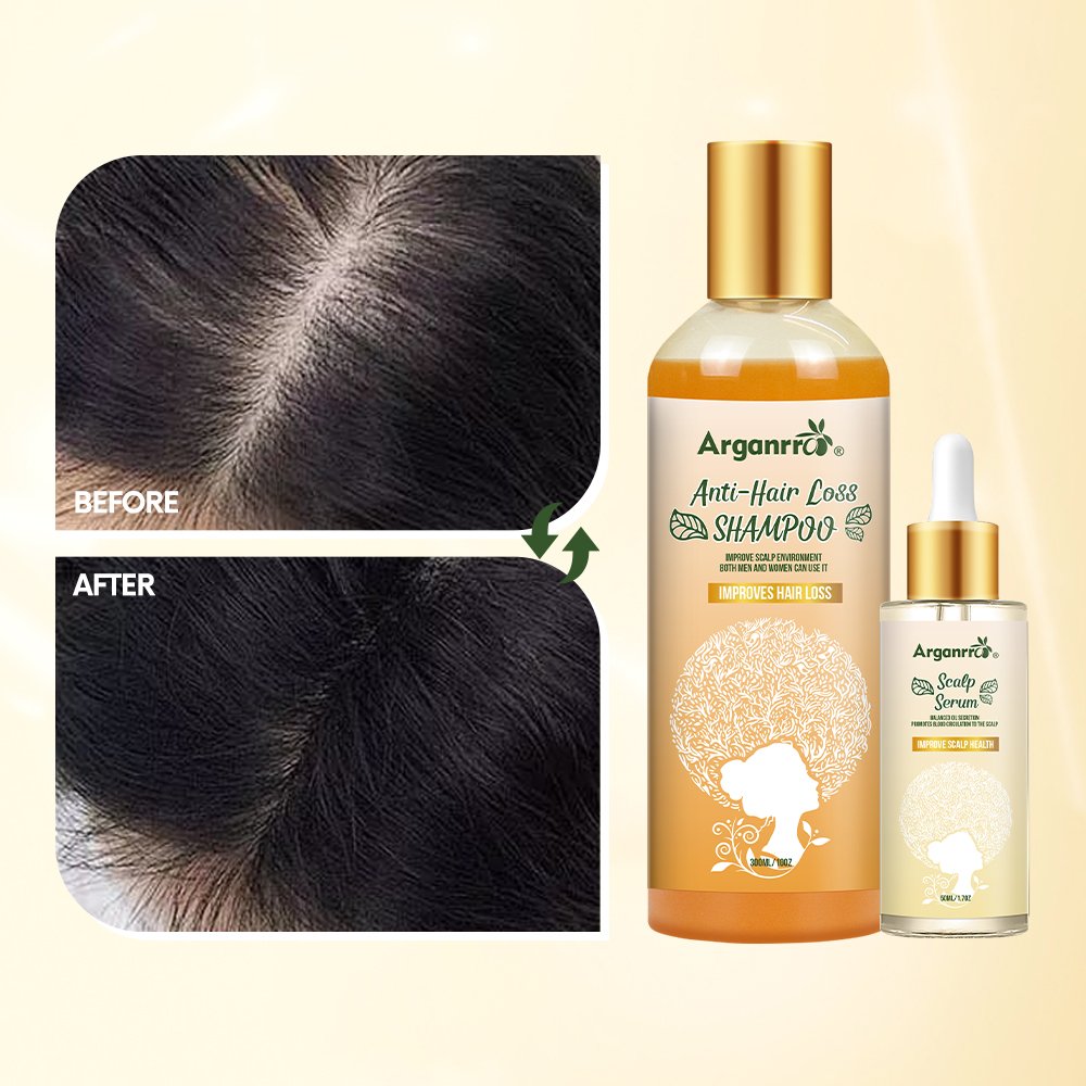 Private Label Organic natural hair care set anti loss hair shampoo and serum for Hair Growth Sulfate Free