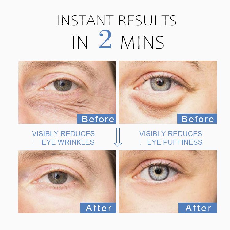 New shape needle tube can be customized to remove facial wrinkles firming skin eye cream