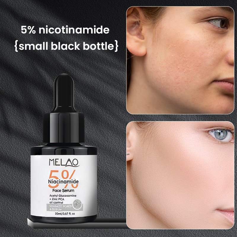 Brightening Skin Whitening Moisture Hyaluronic Acid Serum Dark Spot Corrector Brighten The Skin Care Niacinamide 5% Face Serum
