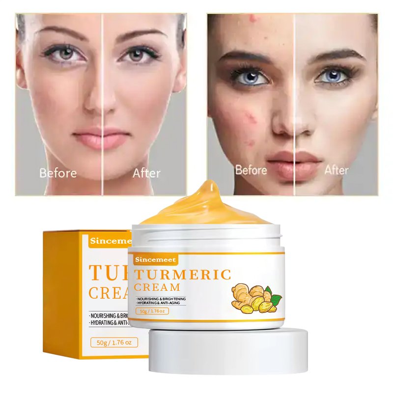 Antiaging Dark Spot Remover Acne Treatment Vitamin C Turmeric Cream Face Moisturising Cream Organics Skin Whitening Cream