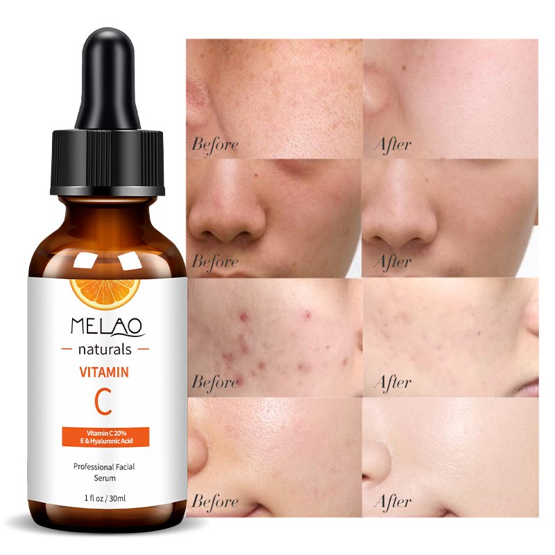 New Design Private Label Organic Whitening Brightening Anti Wrinkle Vitamin C Face Serum