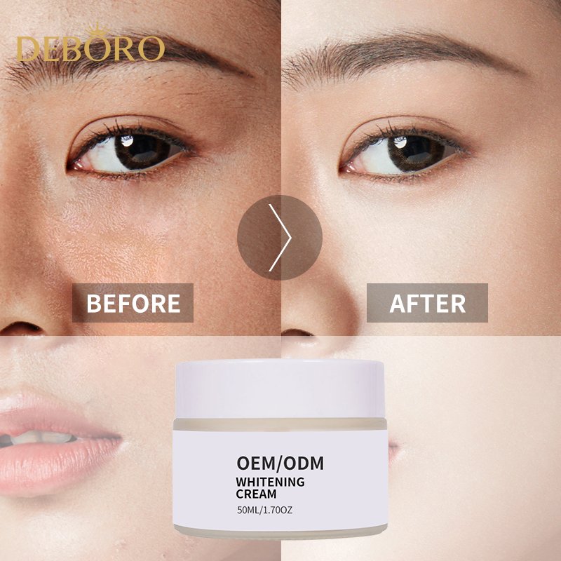 Hot Sale Whitening Natural Herbal Intimate Beauty Whitening Cream Whitening Cream For Face And Body