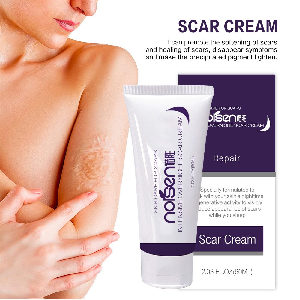 Private Label Organic Deep Scar Removing Treatment Repair Anti Pimples Marks Stretch Cream Acne Stretch Marks Scar Removal Cream